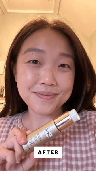Lee after applying the RoC Retinol Correxion Serum